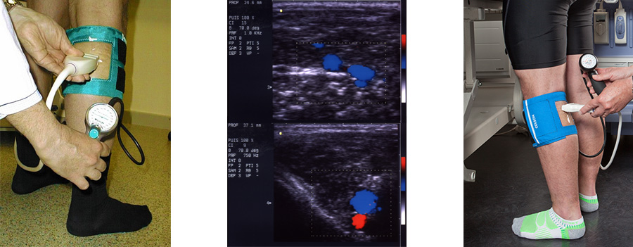 bandeau_doppler_scanner